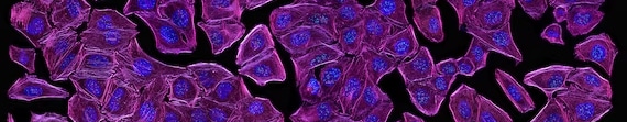 Protéine - cytosquelette - alimax.ch - Santé, bien-être, beauté et longévité par l'alimentation - Recherche en nutrition, diététique et aromathérapie - Michel Bondallaz